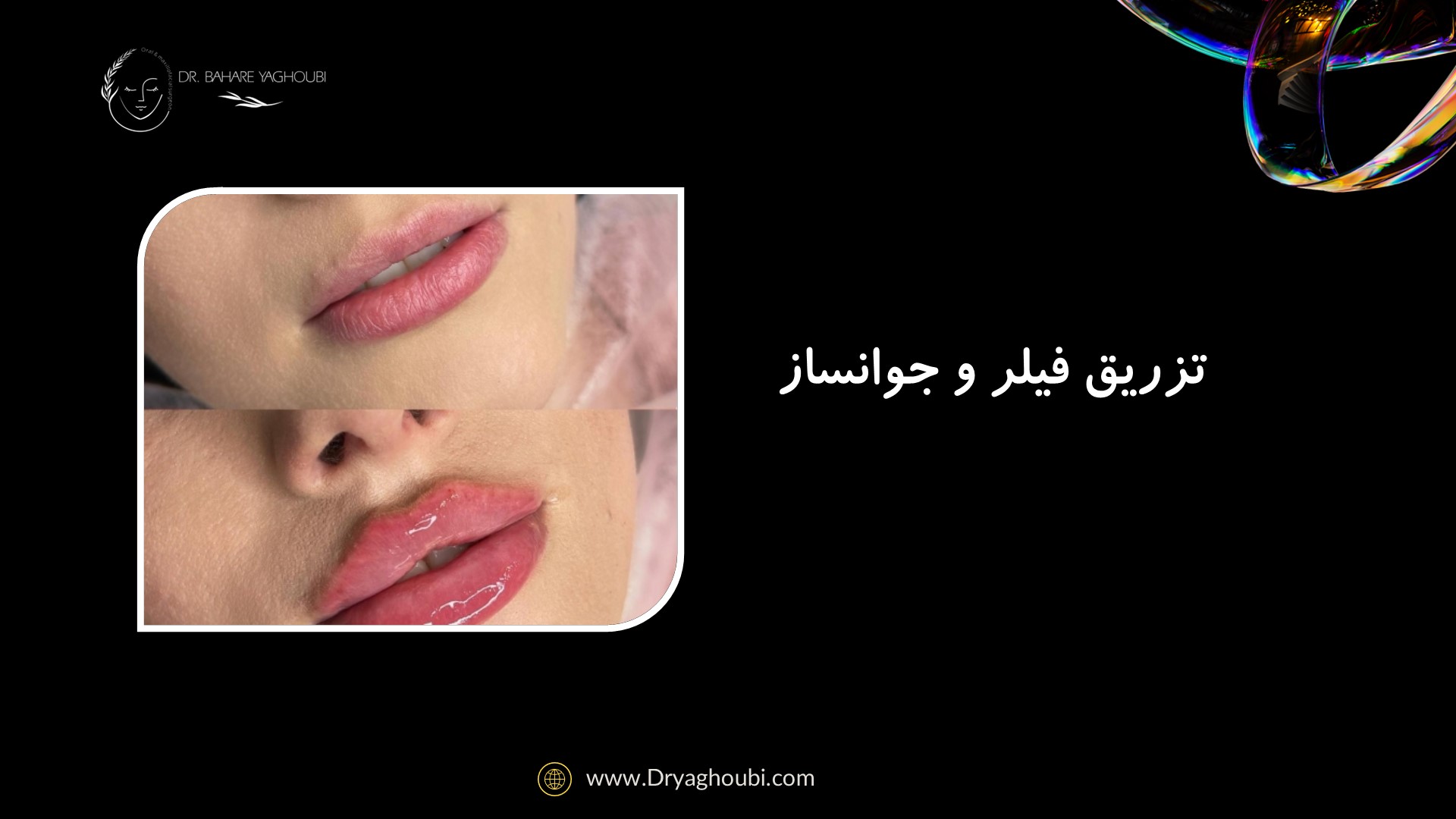 خدمات تزریق فیلر و جوانساز